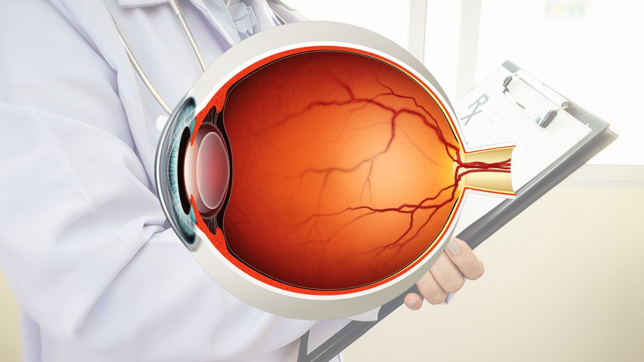 Obat Ablasi Retina Resep Herbal HNI HPAI